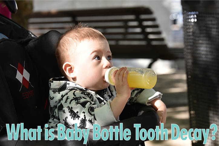 baby-bottle-tooth-decay