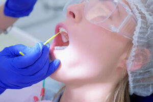dental patient undergoing fluoride treatment
