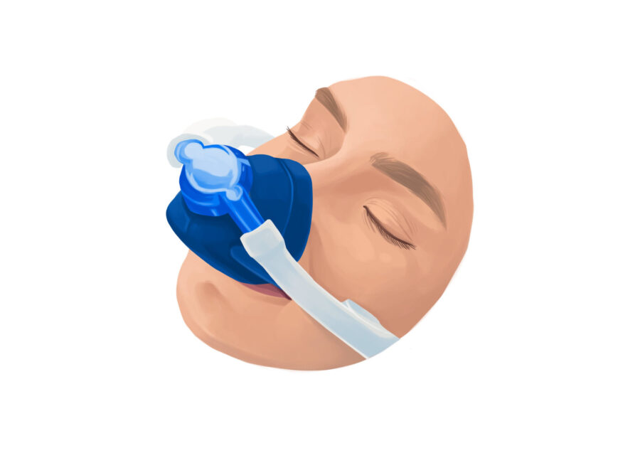 dental sedation, nitrous oxide for sedation dentistry